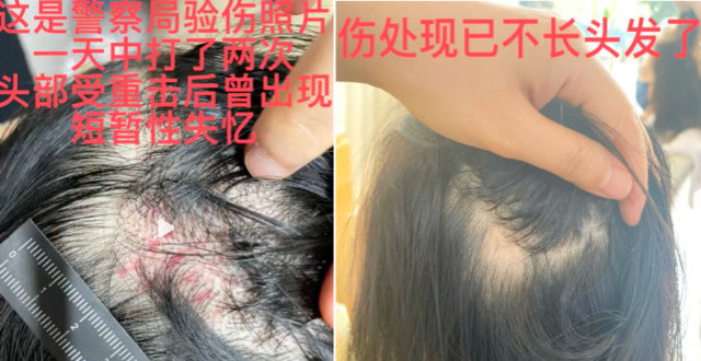 演员王东家暴视频曝光！用木板砸老婆狂骂脏话，女方头皮撕裂严重